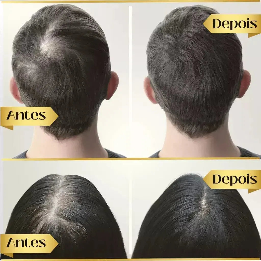 Repair Hair Regrowth - Óleo de Crescimento Capilar