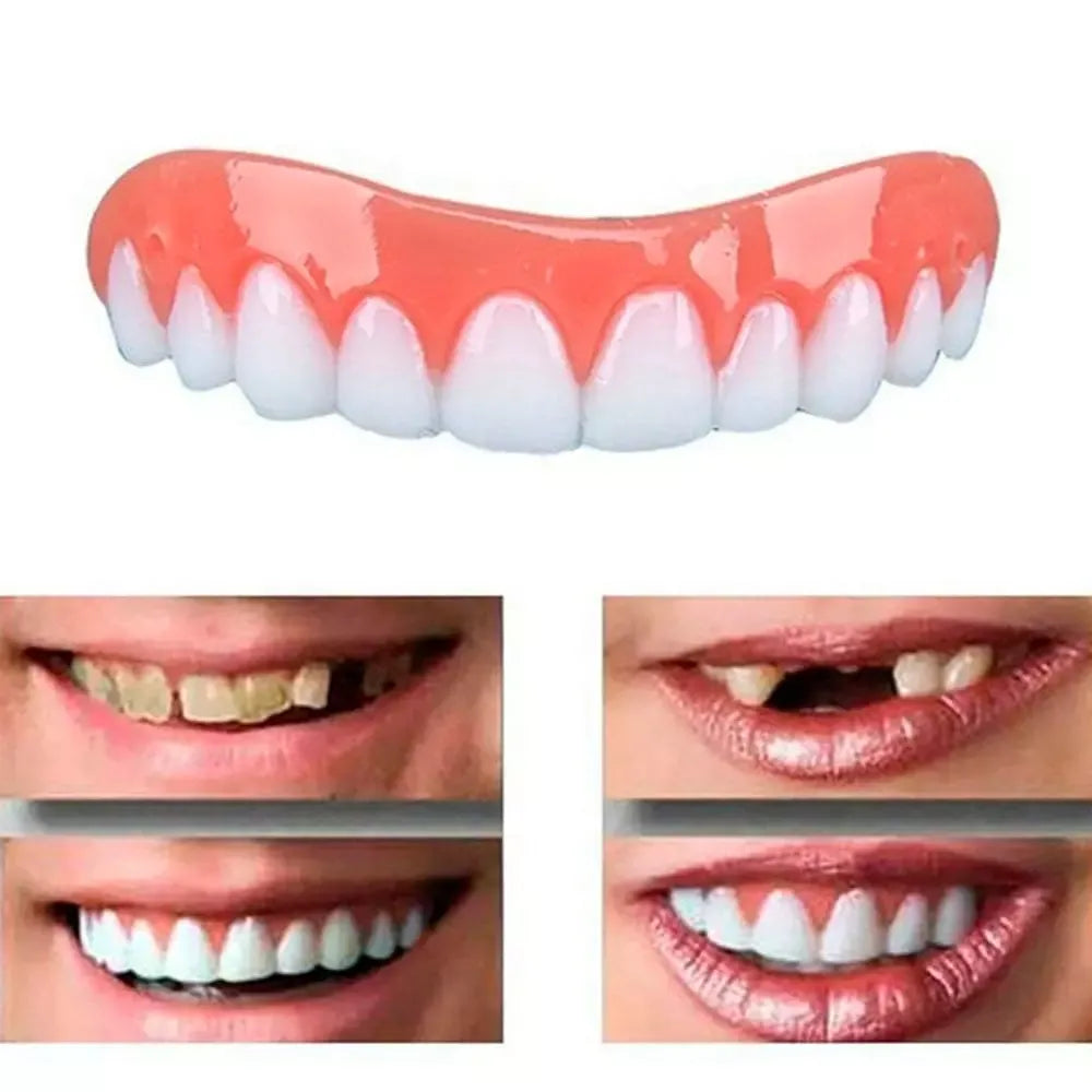 Dentadura NewSmile - Tenha o Sorriso Dos Seus Sonhos